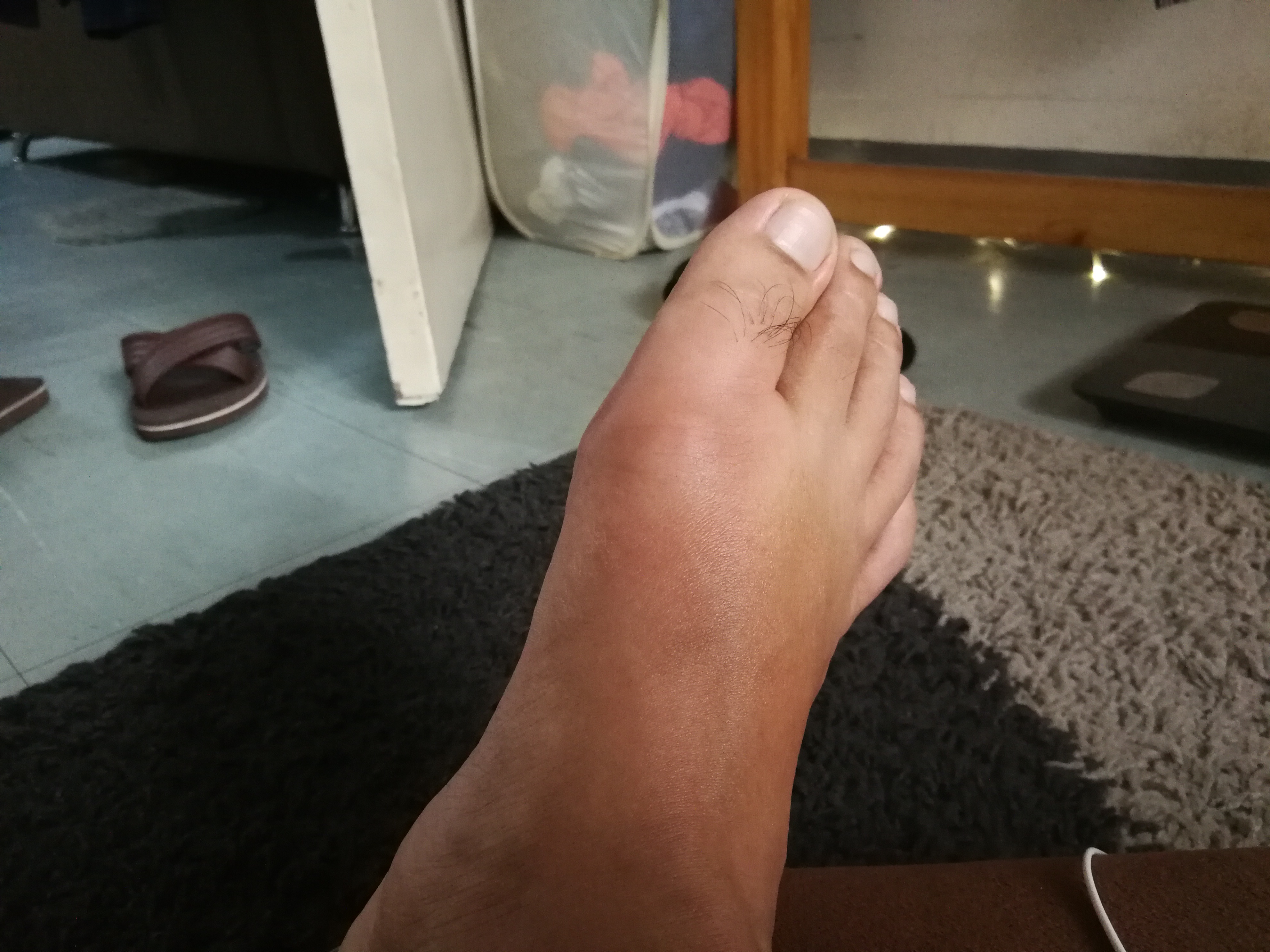 gout and keto